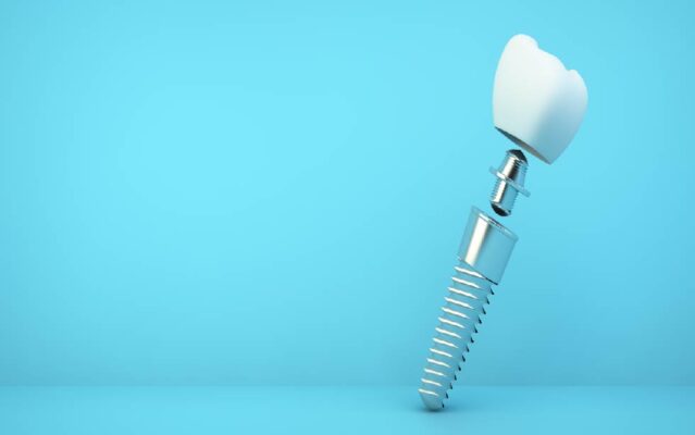 รากฟันเทียม คือ วัสดุที่ใช้ทดแทนรากฟันที่เสียไป มีลักษณะเป็นเกลียวคล้ายกับน็อต